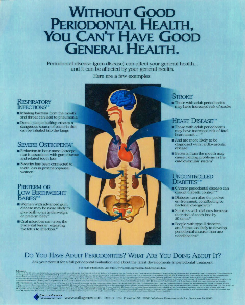 Inforgraphic explaining overall affect periodontal disease has on the body